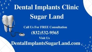 Dental Implants Sugar Land TX